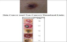 Skin Lesion Image Comparison
