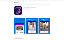 Hair Transplant AI Success