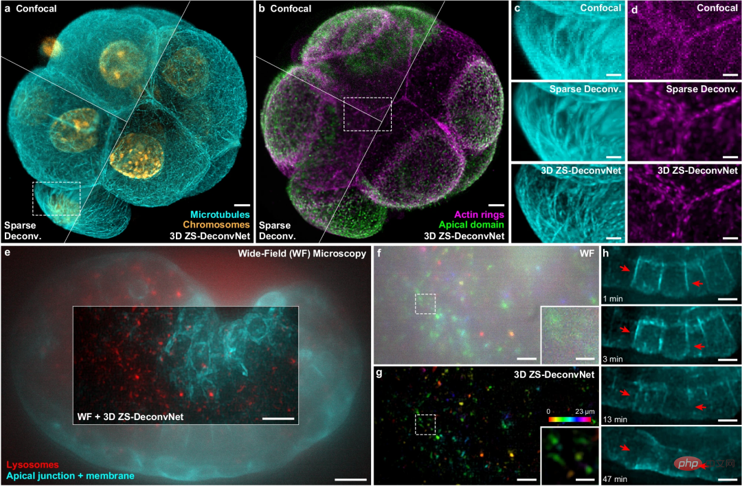 1.5 times beyond the diffraction limit, imaging conditions are 10 times lower, Tsinghua University and the Chinese Academy of Sciences use AI methods to improve microscope resolution