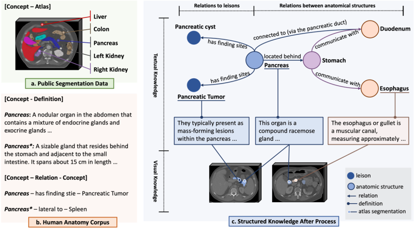 The open source 3D medical large model SAT supports 497 organoids and has performance exceeding 72 nnU-Nets. It was released by the Shanghai Jiao Tong University team.