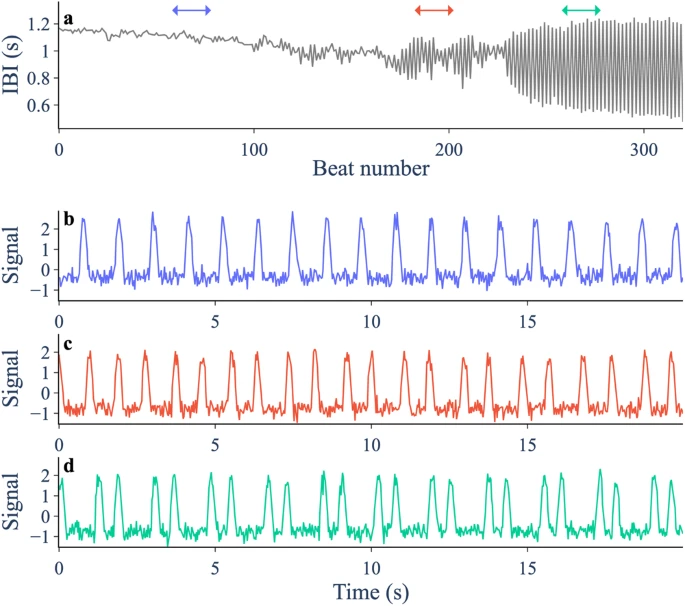 Predicting discrete-time bifurcations through deep learning