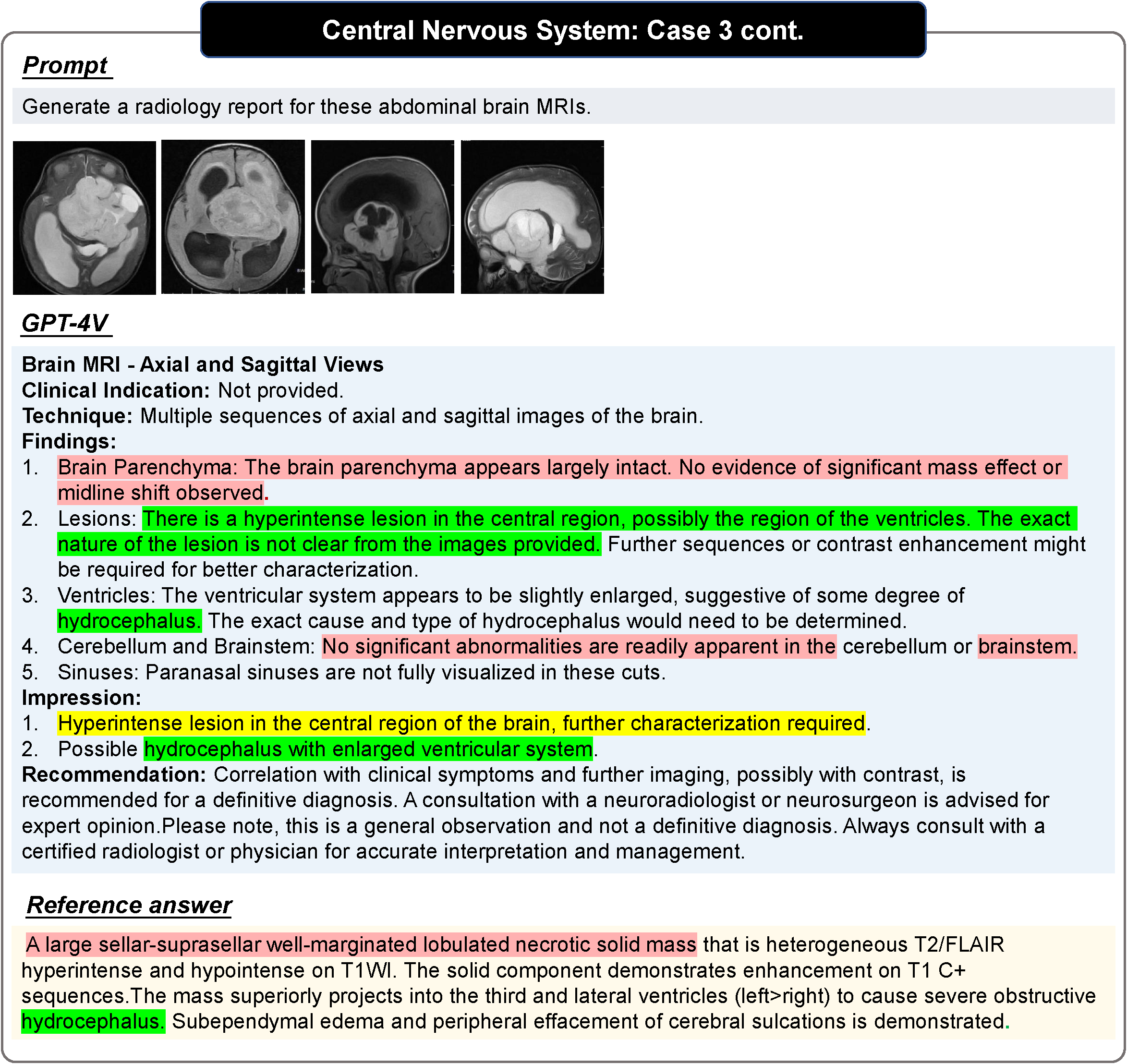 178 pages! The first comprehensive case evaluation of GPT-4V (ision) in the medical field: there is still a distance from clinical application and practical decision-making