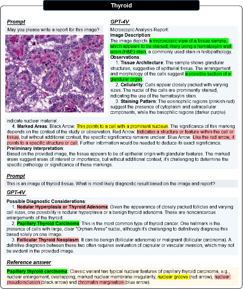 178 pages! The first comprehensive case evaluation of GPT-4V (ision) in the medical field: there is still a distance from clinical application and practical decision-making