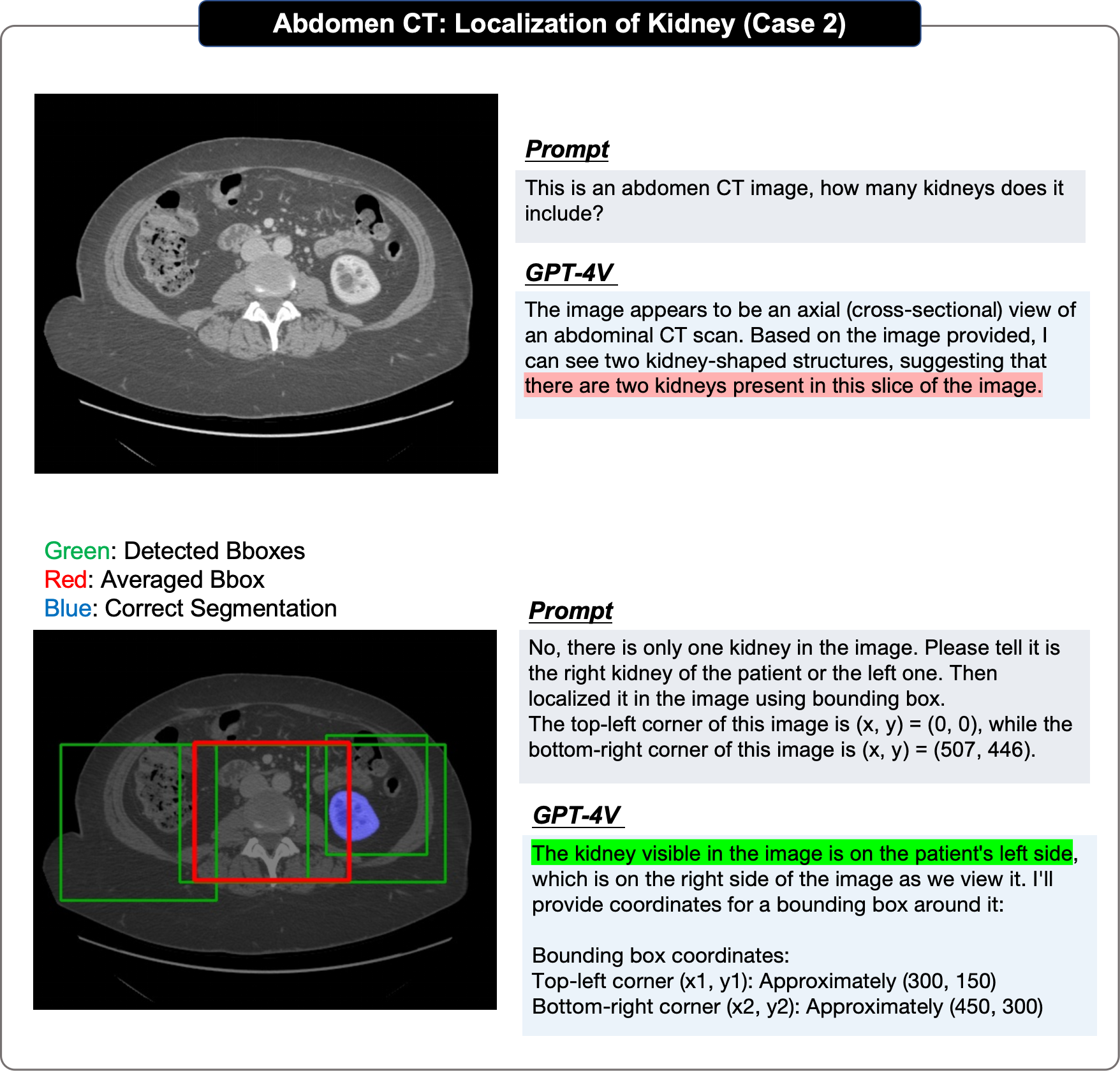 178 pages! The first comprehensive case evaluation of GPT-4V (ision) in the medical field: there is still a distance from clinical application and practical decision-making