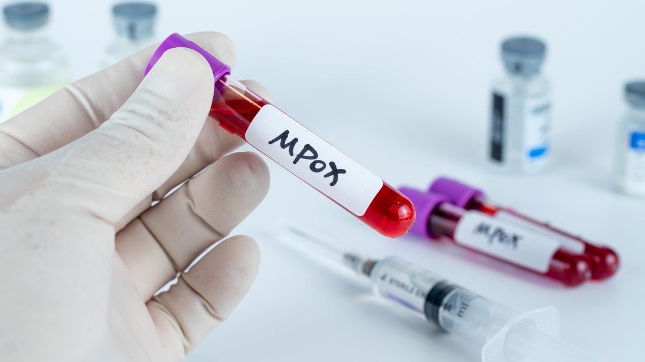 ポリマーケットのベッターは、MPOX がパンデミックになる可能性は 20% と予想