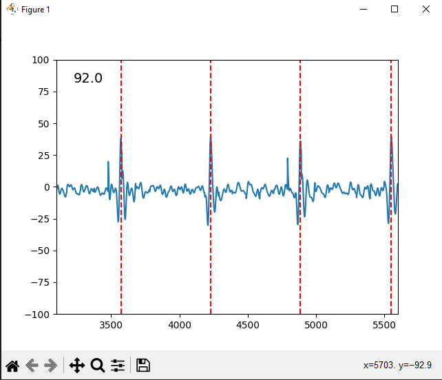 Simple DIY HR Monitor+ECG Display