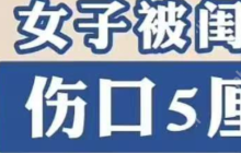 一女子情绪激动用菜刀砍闺蜜头部,伤口5厘米,后续行政拘留10天罚款500元。