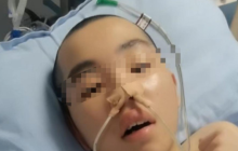 14岁男生嬉闹时被女同学打中左胸后瘫痪 后续治疗陷困境