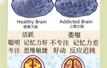 运动与电子屏幕使用方式影响青少年大脑发育