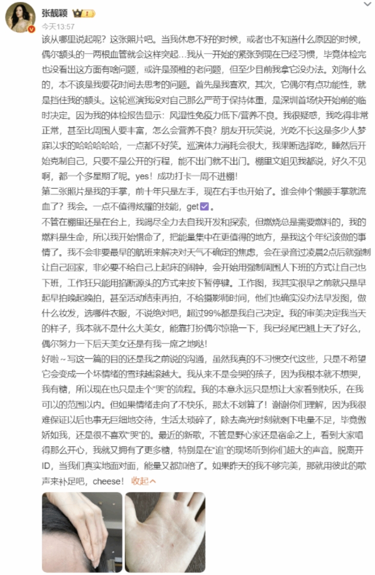 张靓颖一伸懒腰手掌就流血怎么回事 张靓颖一伸懒腰手掌就流血详情介绍 - php中文网