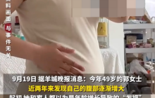 49岁女子长10斤肌瘤如同足月孕妇是怎么回事？详情介绍