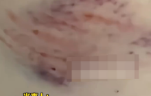 孕妇被未栓绳狗追咬胎停主人拒赔是怎么回事？详情介绍
