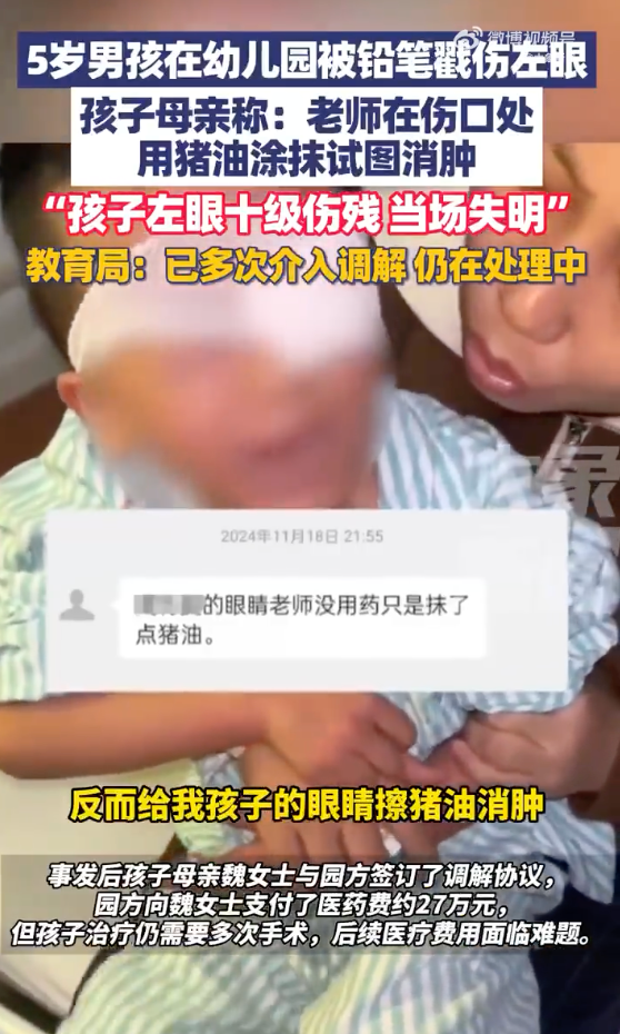 教育局回应5岁男孩在幼儿园被戳伤左眼：已多次介入调解