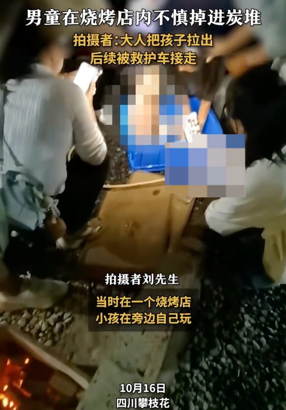 男童掉進(jìn)燒烤店炭堆全身燒傷是怎么回事？詳情介紹