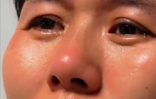 34岁女子1岁被拐养母割掉其胎记 养父痛哭无能为力次年去世