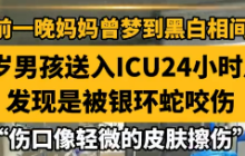 广东小孩进ICU24小时后才知被蛇咬伤是怎么回事？详细介绍