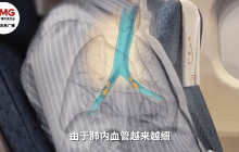 为什么这个习惯会导致十余人险些截肢？详情介绍