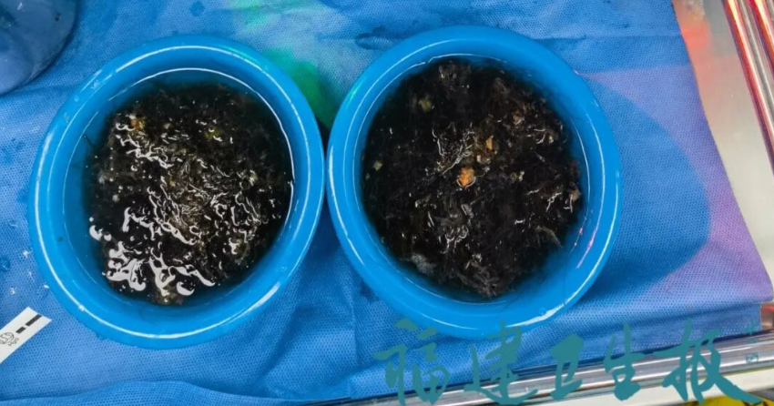10岁女孩确诊！已有多起病例，有人因羞耻感延误就医