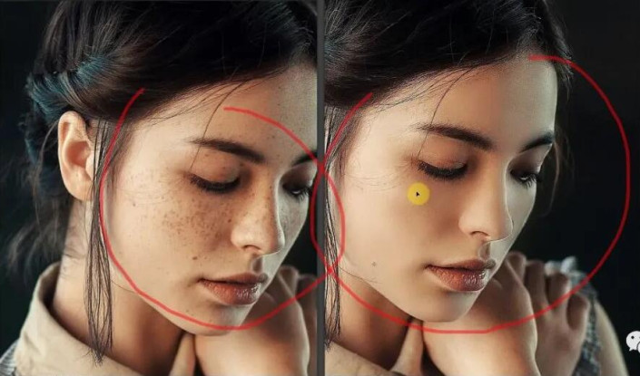 So bedienen Sie die PS-Charakter-Dermabrasion