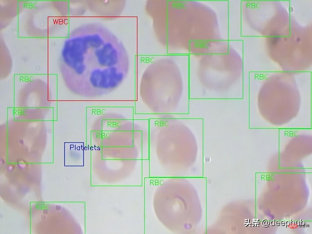 Une brève analyse de l'apprentissage actif des données d'image cellulaire