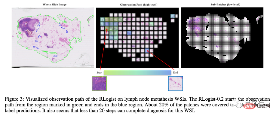 The AI ​​that plays the game well is already treating patients and saving lives.