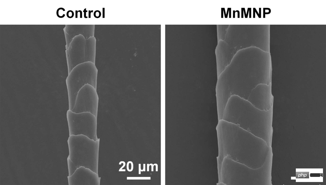 AIは抜け毛を治すことができるのか？中国の科学者が新しい毛髪再生治療法を提案