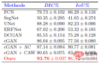 Recommended paper: Segmentation and classification of breast tumors in ultrasound images based on deep adversarial learning Recommended paper: Segmentation and classification of breast tumors in ultrasound images based on deep adversarial learning