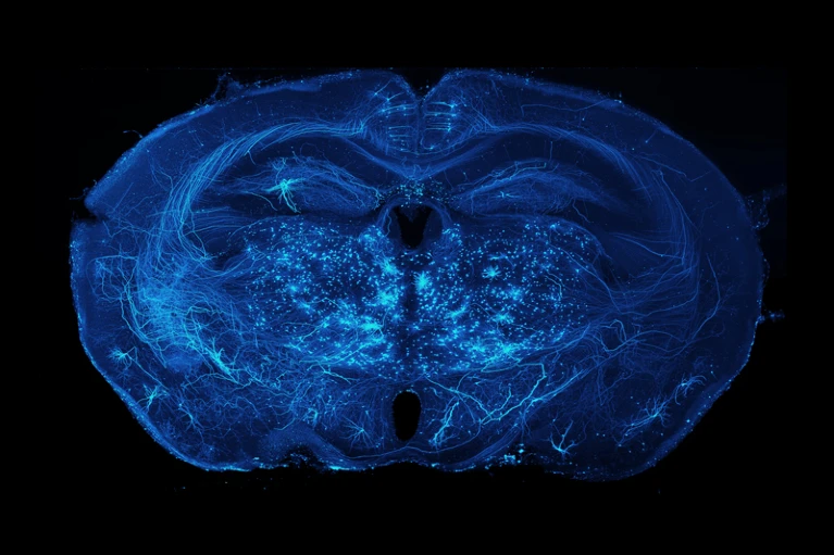 谷歌科学家 Nature 评论：人工智能如何更好地理解大脑