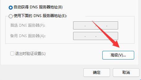 Bagaimana untuk menukar protokol tcp dalam win11? Butiran cara menukar protokol tcp dalam sistem win11