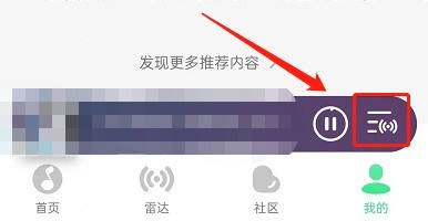 How to turn off radar mode in QQ Music_Tutorial on turning off radar mode in QQ Music