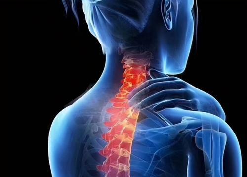 Relief methods for compressed nerves in the cervical spine (effective measures and suggestions to relieve compressed nerves in the cervical spine)