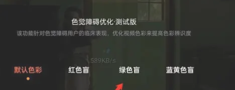 Tencent Video 컬러 비전 최적화를 어디에서 설정합니까?