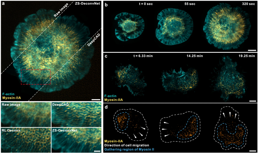 1.5 times beyond the diffraction limit, imaging conditions are 10 times lower, Tsinghua University and the Chinese Academy of Sciences use AI methods to improve microscope resolution