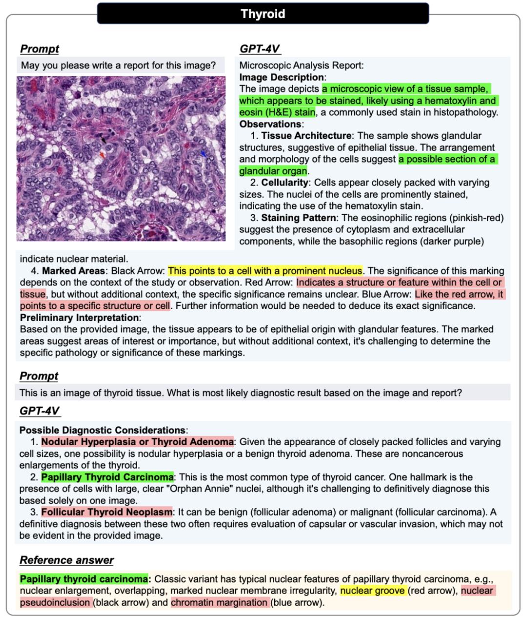 178页,128个案例,GPT-4V医疗领域全面测评,离临床应用与实际决策尚有距离