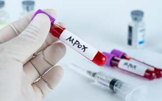 Les parieurs de Polymarket donnent à Mpox 20 % de chances de devenir une pandémie