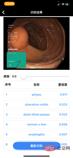 Robot de diagnostic gastro-intestinal Inchworm piloté par une bobine SMA