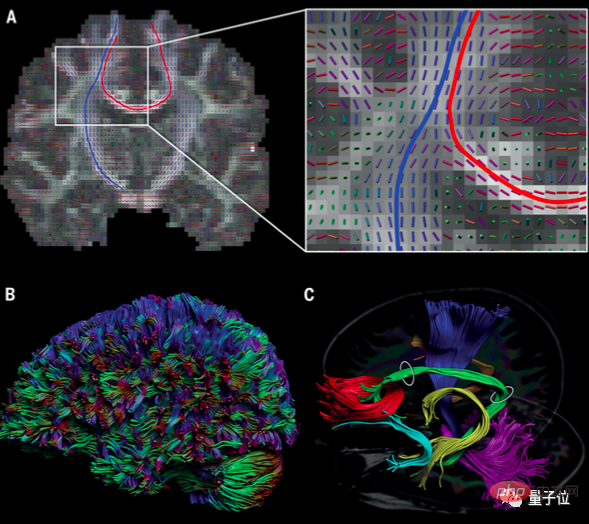 Le cloisonnement du cerveau n’est pas la clé du fonctionnement ! Science couvre 4 articles publiés daffilée : La sagesse naît de la connexion entre les zones du cerveau