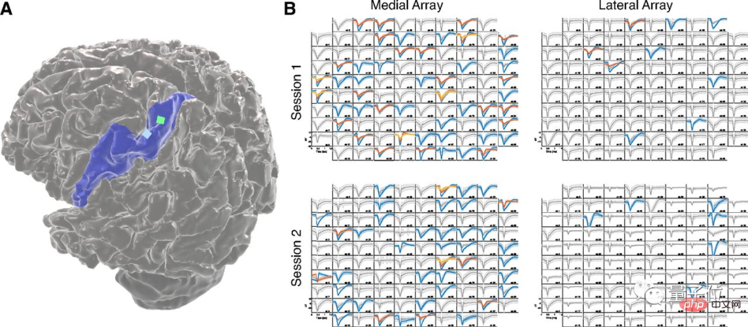 Your brain really learns automatically while you sleep! The first human experimental evidence: accelerated replay by 1-4 times