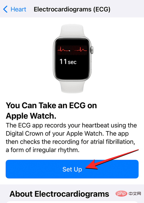 Apple Watch で心電図を記録する: ステップバイステップのチュートリアル