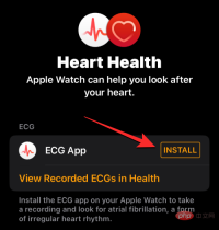 Record an EKG on Apple Watch: Step-by-Step Tutorial