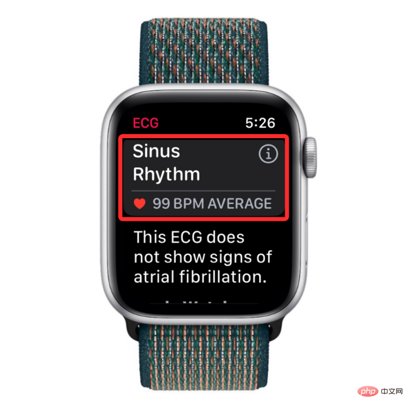 take-an-ecg-reading-on-apple-watch-9-a