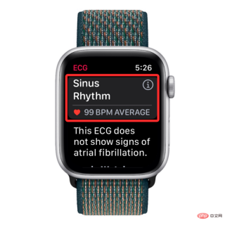 Record an EKG on Apple Watch: Step-by-Step Tutorial