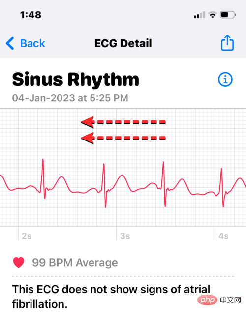 Apple Watch で心電図を記録する: ステップバイステップのチュートリアル