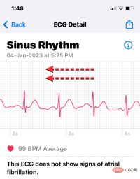 Record an EKG on Apple Watch: Step-by-Step Tutorial