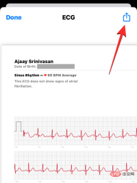 Record an EKG on Apple Watch: Step-by-Step Tutorial
