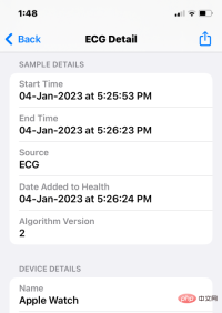 Record an EKG on Apple Watch: Step-by-Step Tutorial