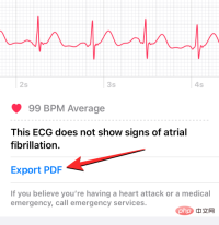 Record an EKG on Apple Watch: Step-by-Step Tutorial