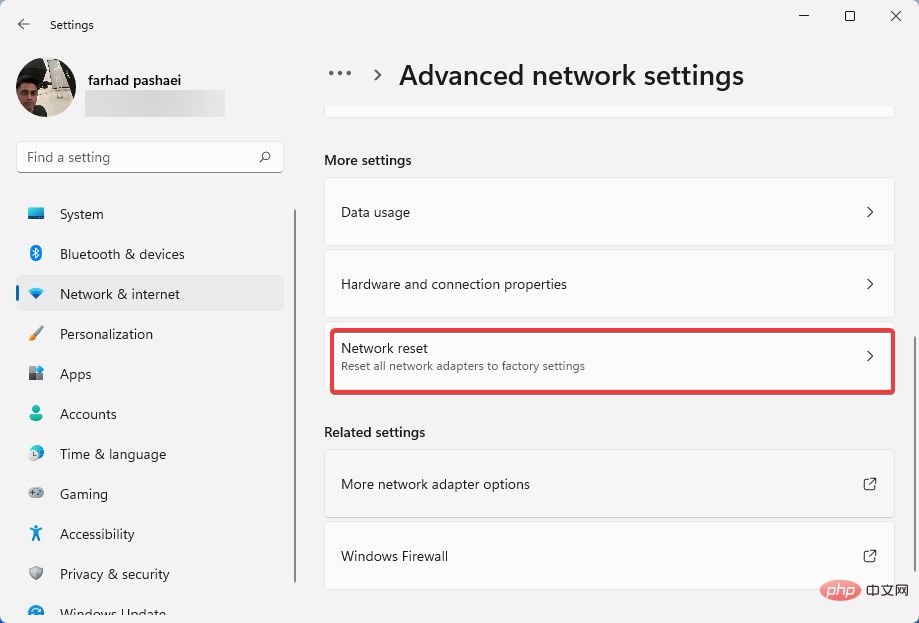 How to fix Windows 11 proxy error [Quick Fix]