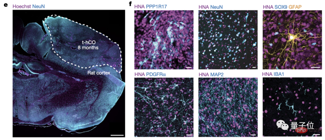 Human-mouse hybrid brain appears! Stanford University 7-year research published in Nature