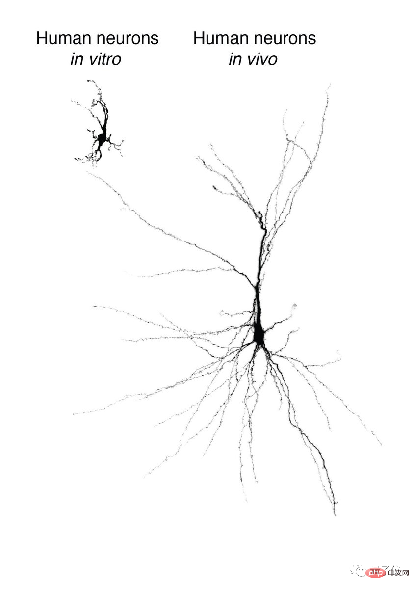 Un cerveau hybride homme-souris apparaît ! Une recherche de 7 ans de l’Université de Stanford publiée dans Nature